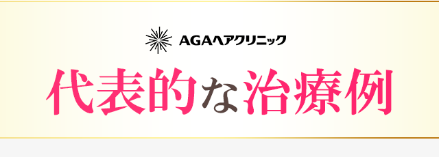 AGAヘアクリニック　代表的な治療事例